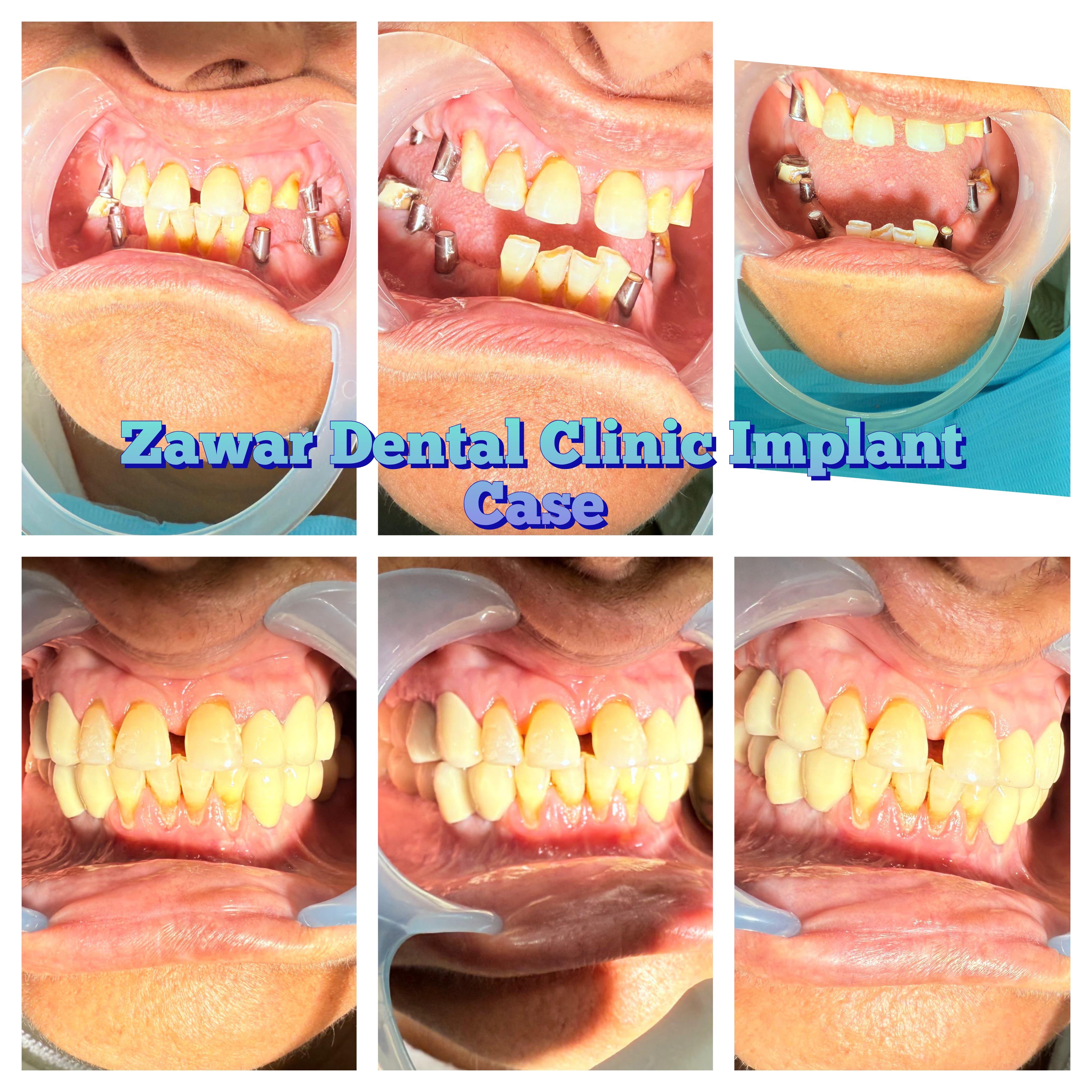 Smile transformation 1