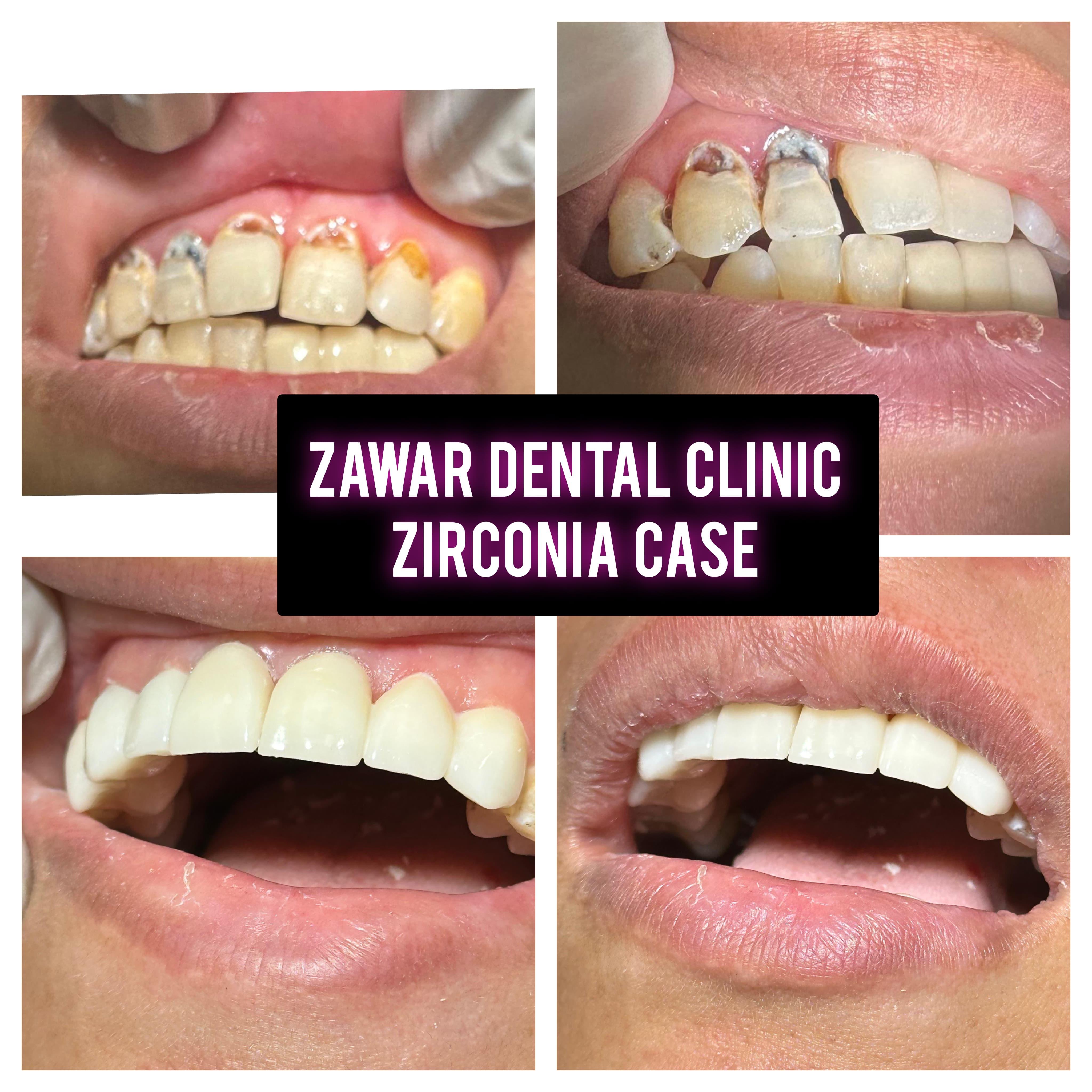 Smile transformation 10