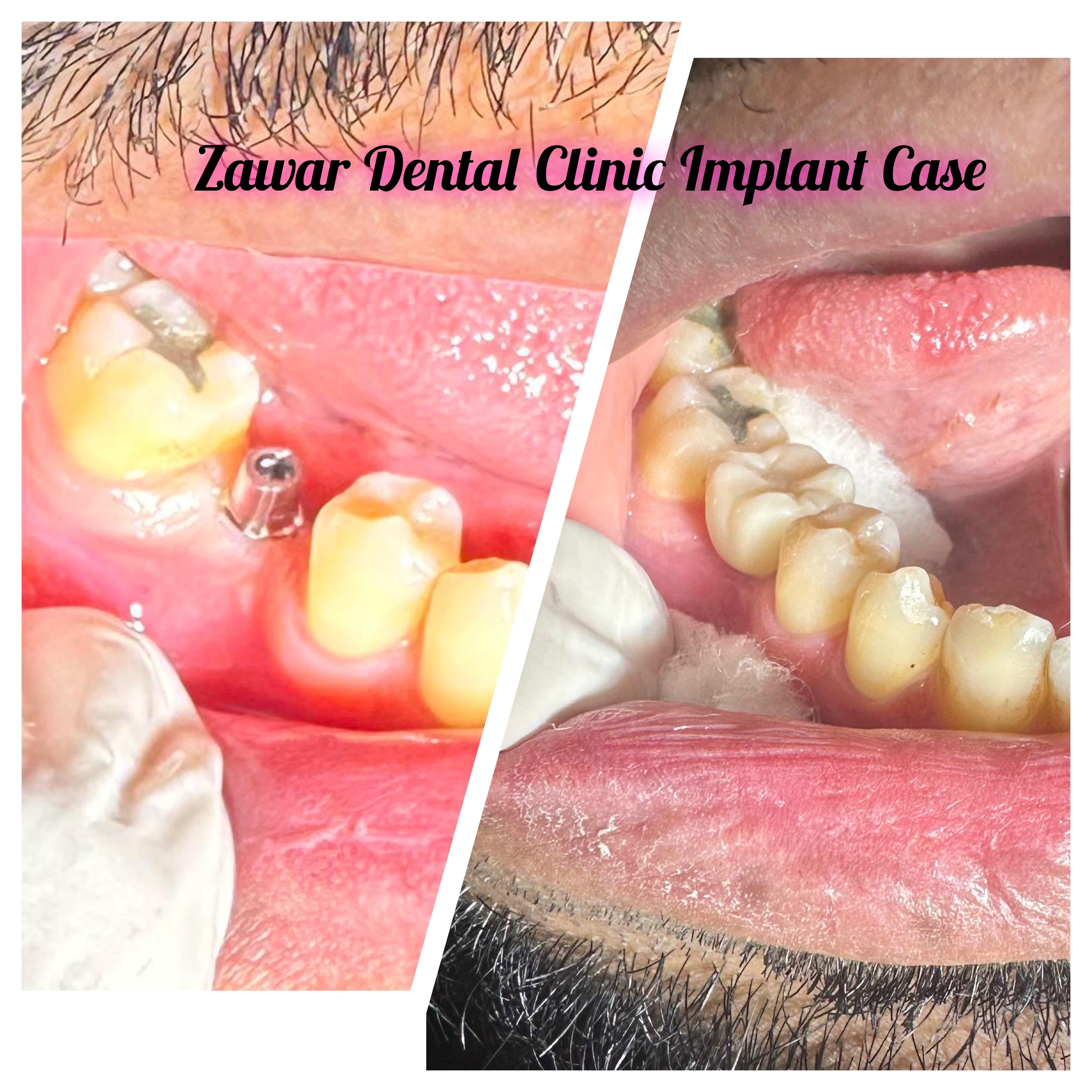 Smile transformation 2