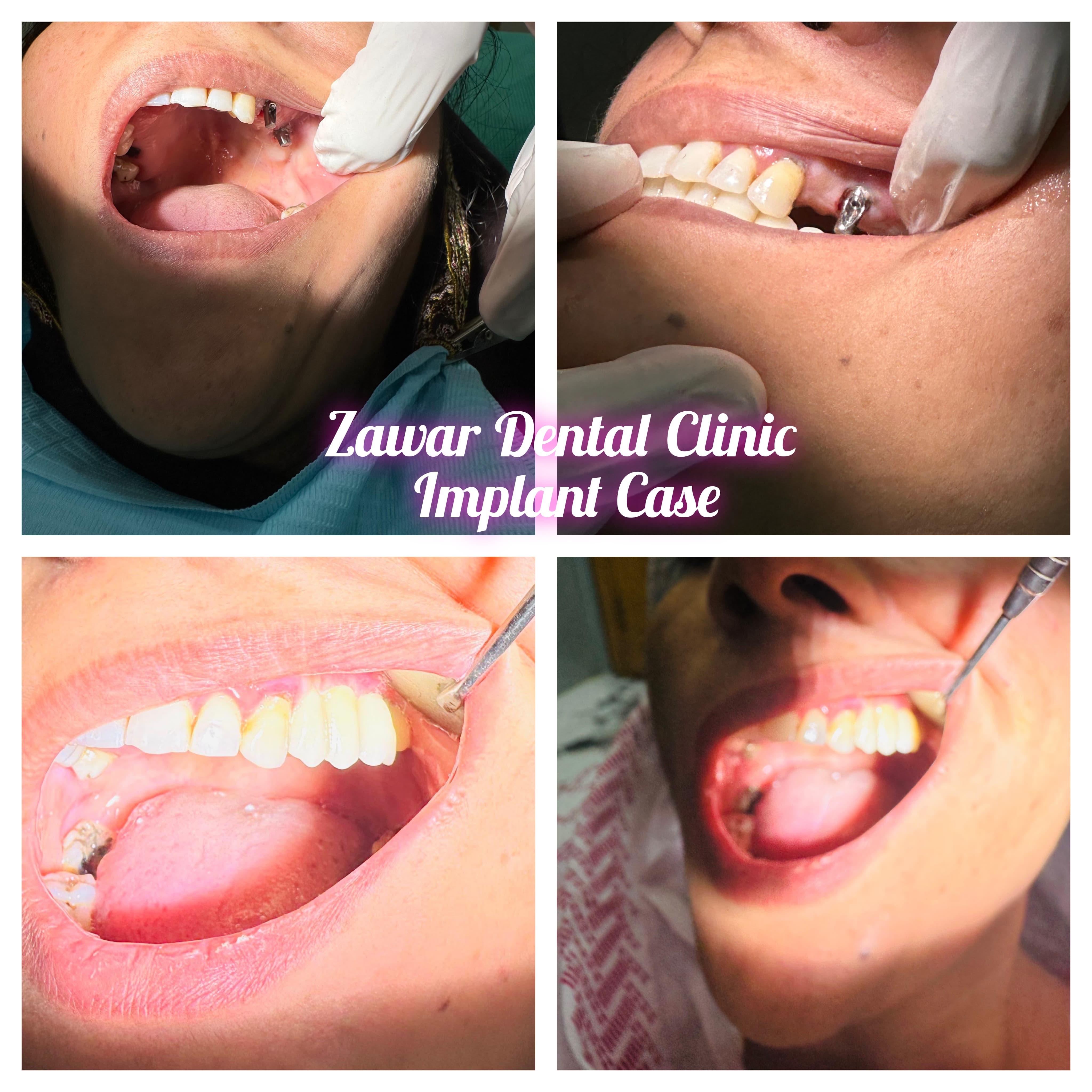 Smile transformation 3