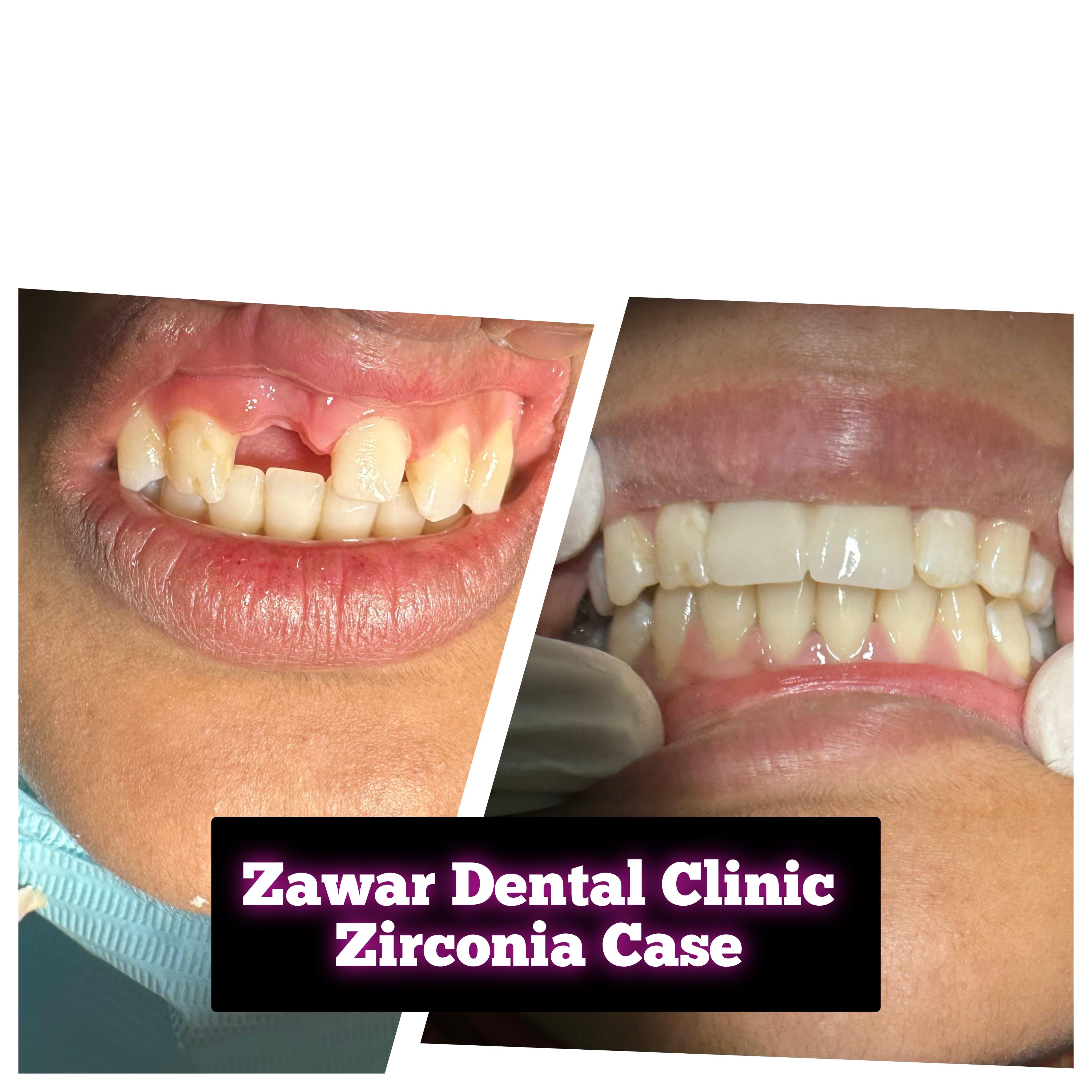 Smile transformation 7