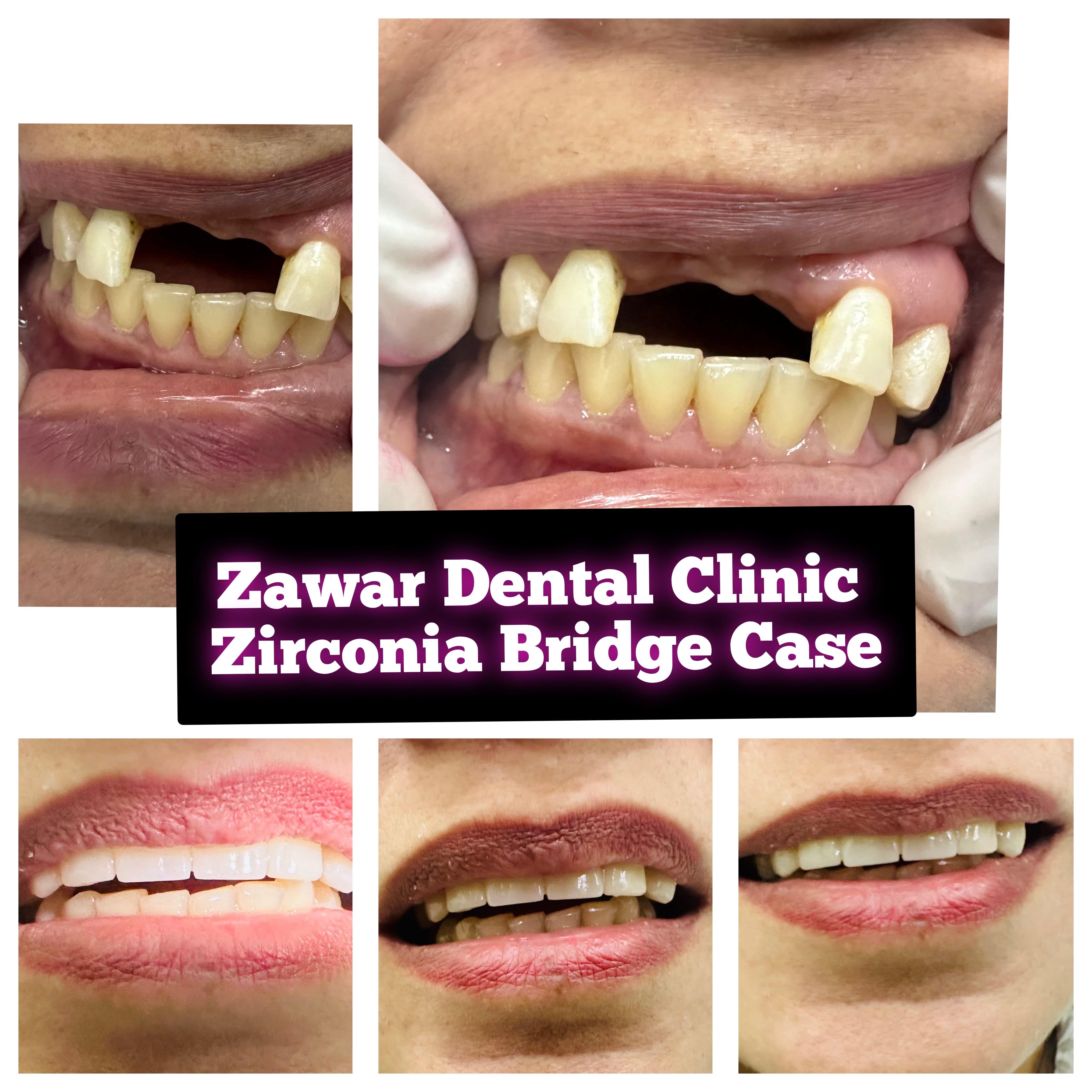 Smile transformation 8