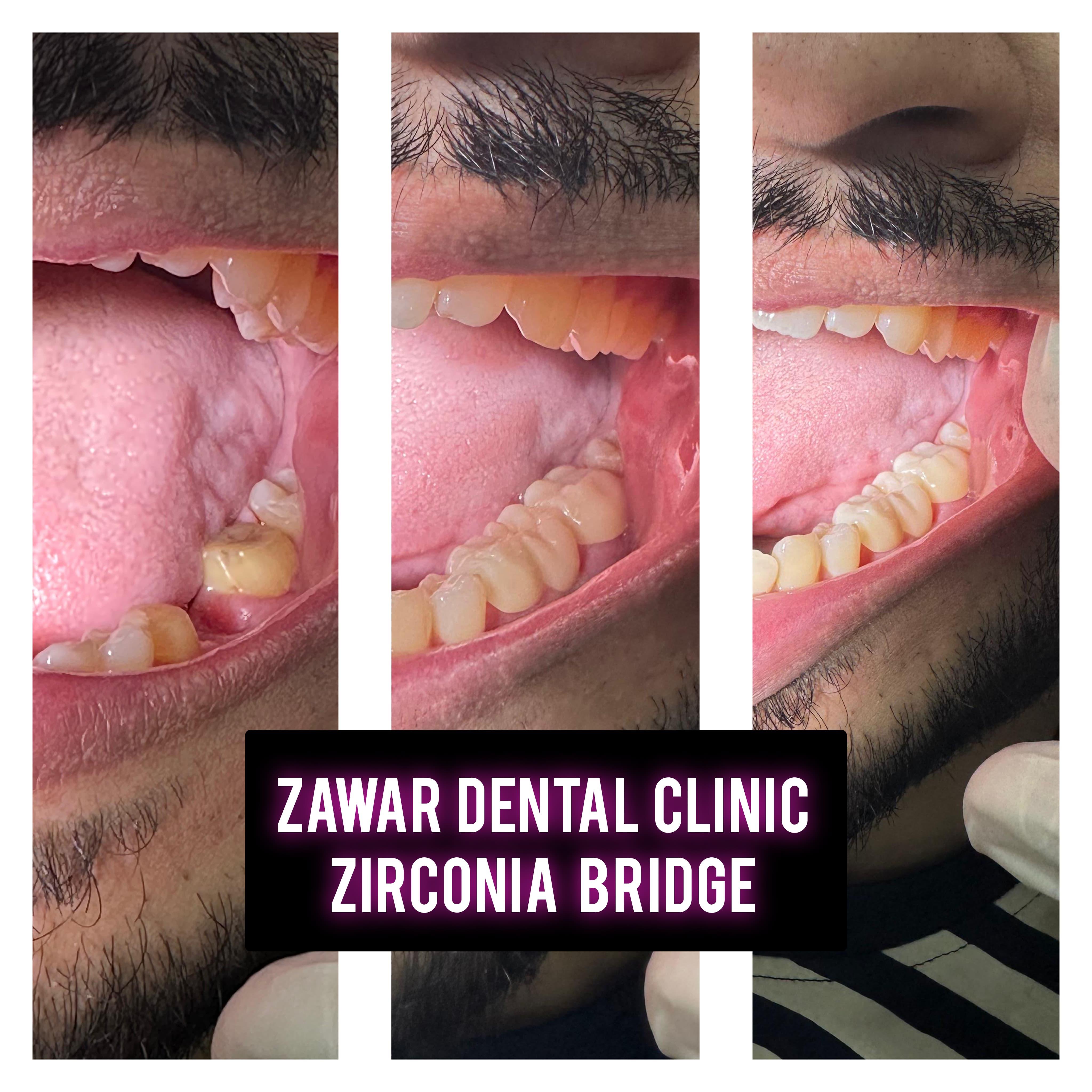 Smile transformation 9