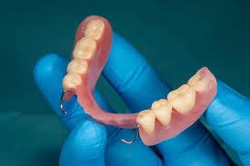 Removable Dentures